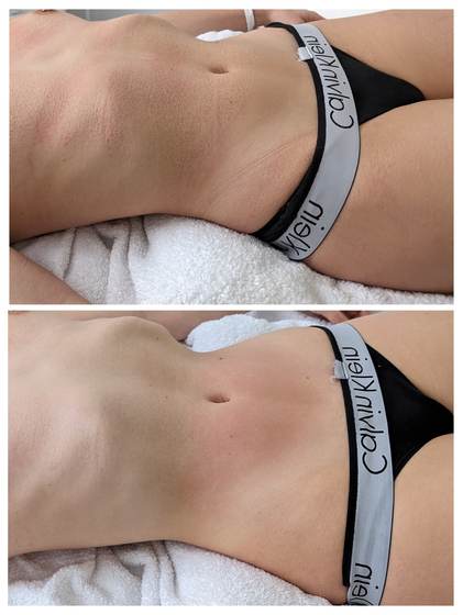 Impression aus dem Dienstags-Massagekurs